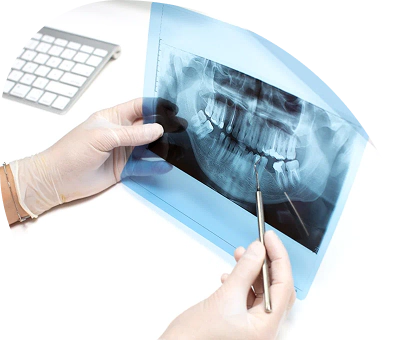Digital dental X-ray imaging for accurate diagnosis and treatment planning