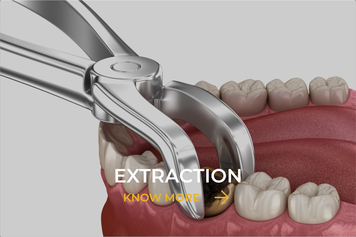 Extraction image