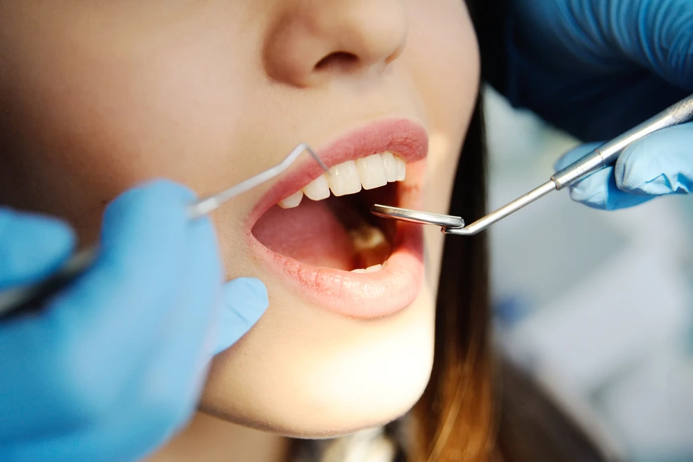 Dental Implants