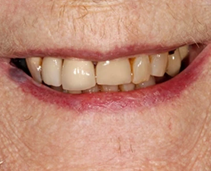 Dental Case 1
