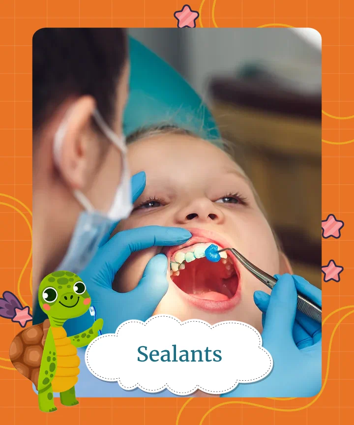 Sealants