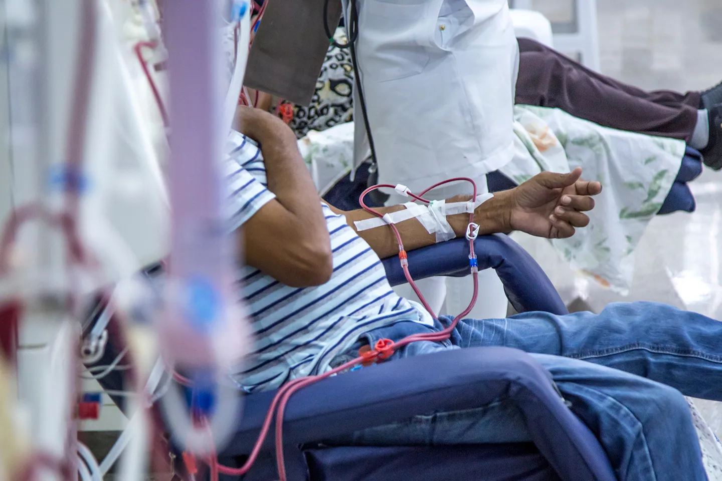 Surgeries for Renal Replacement Therapy