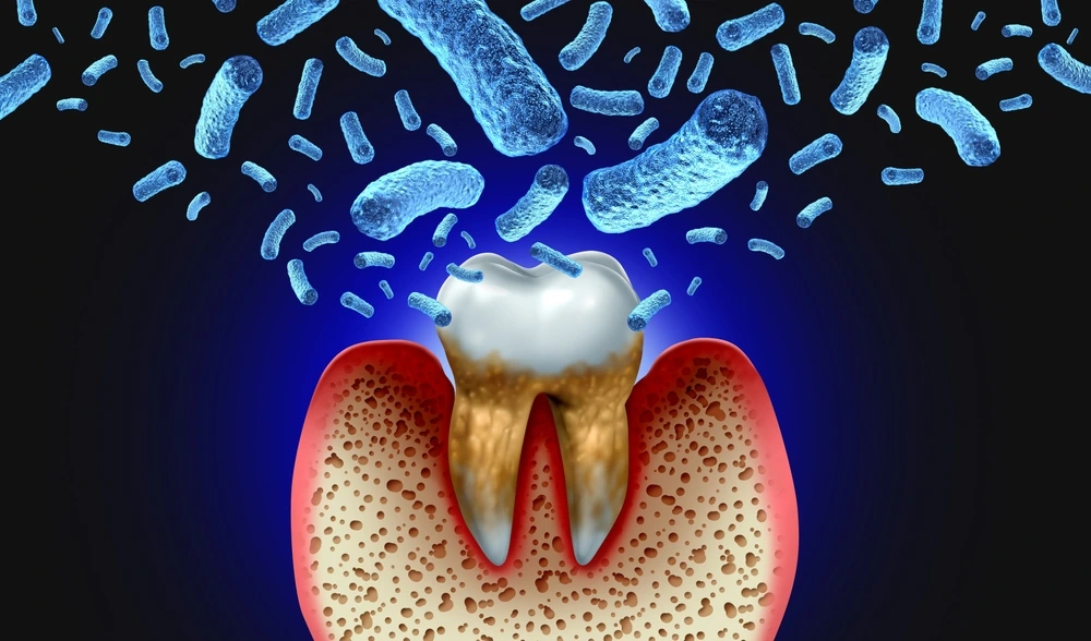 Icon showing a tooth with regenerating bone structure underneath