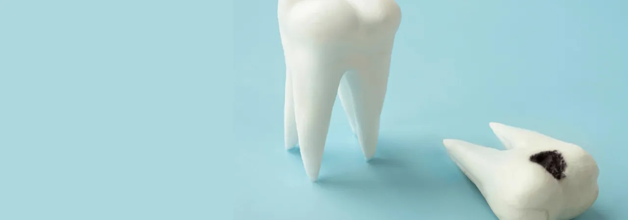 Take Care of Your Teeth to Keep Decay Away!