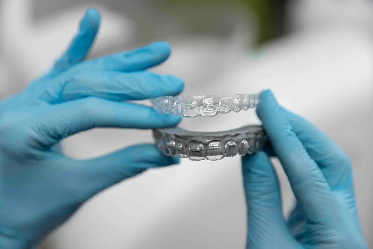 Clear Aligners