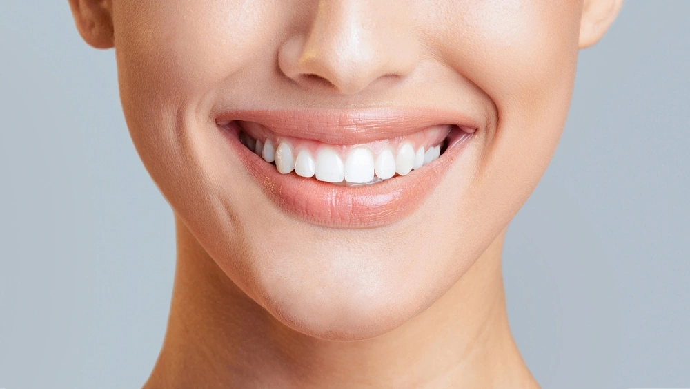 7 Signs It Might Be Time for a Smile Makeover