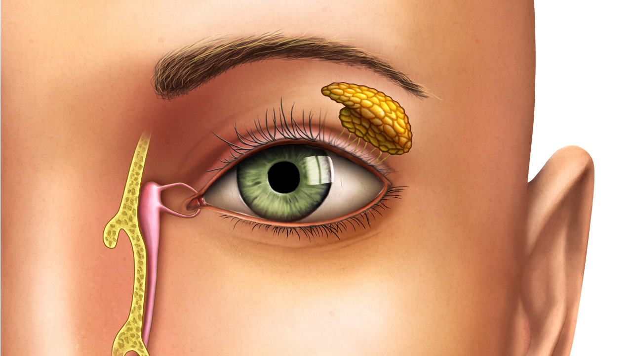 Canaliculitis: Key Causes, Symptoms, and Effective Treatment Methods