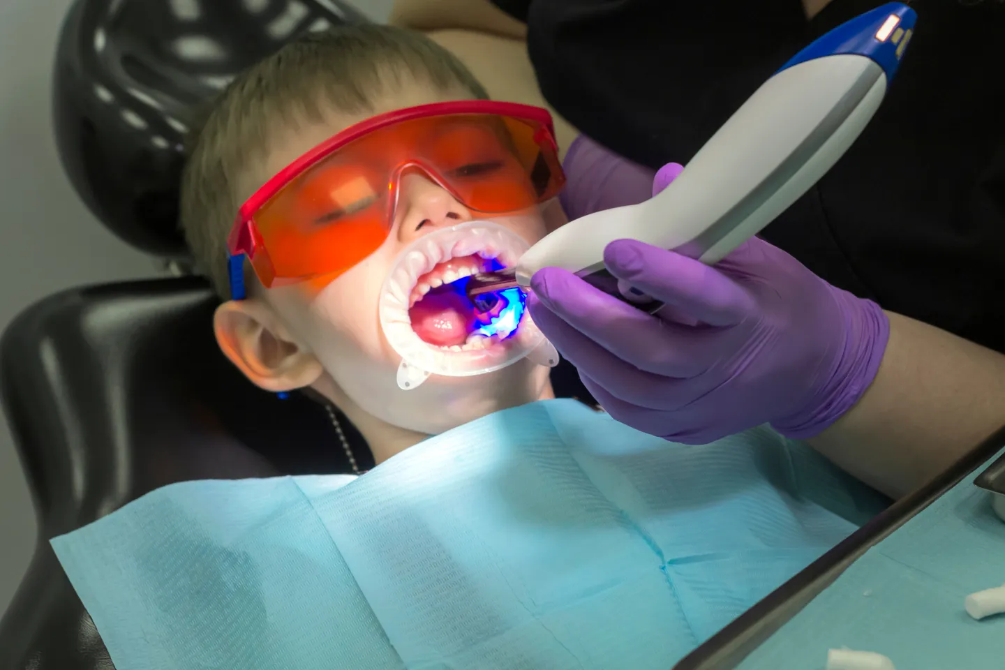 New York, NY Help! Laser Dentistry!