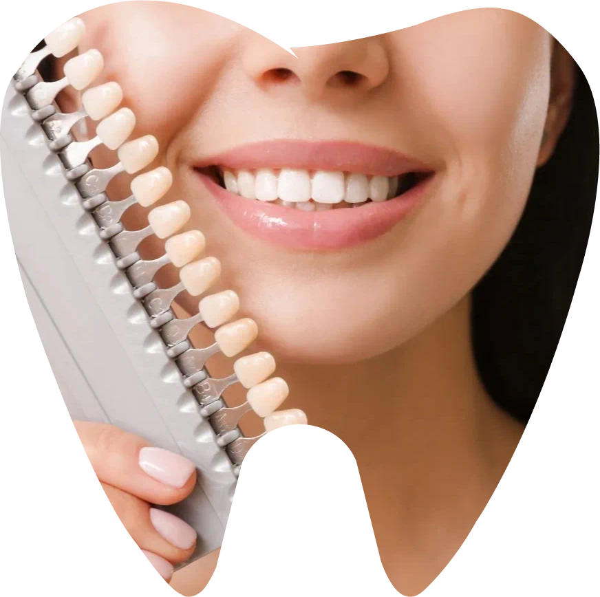 Veneers in Sleepy Hollow, NY