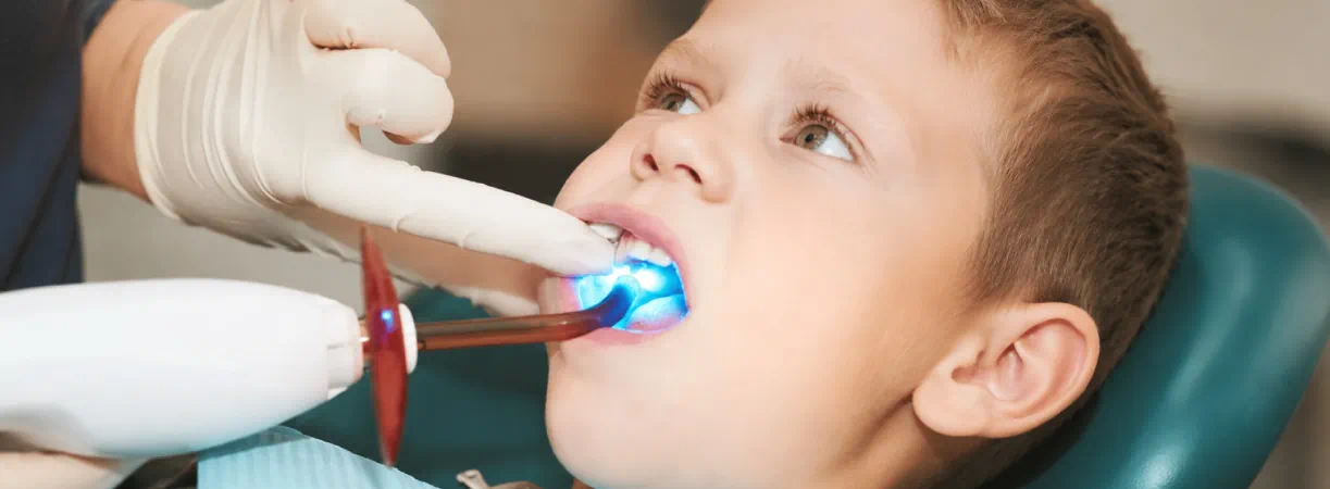 Sealants