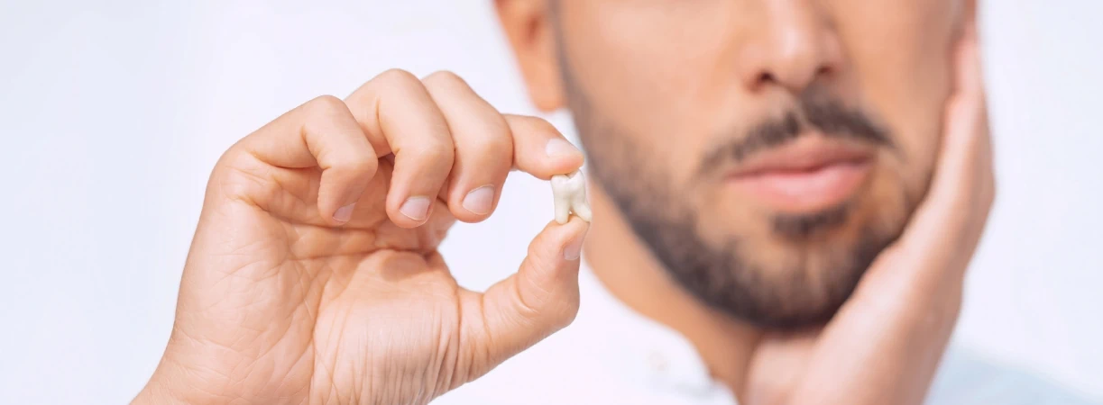 Wisdom Tooth Removal
