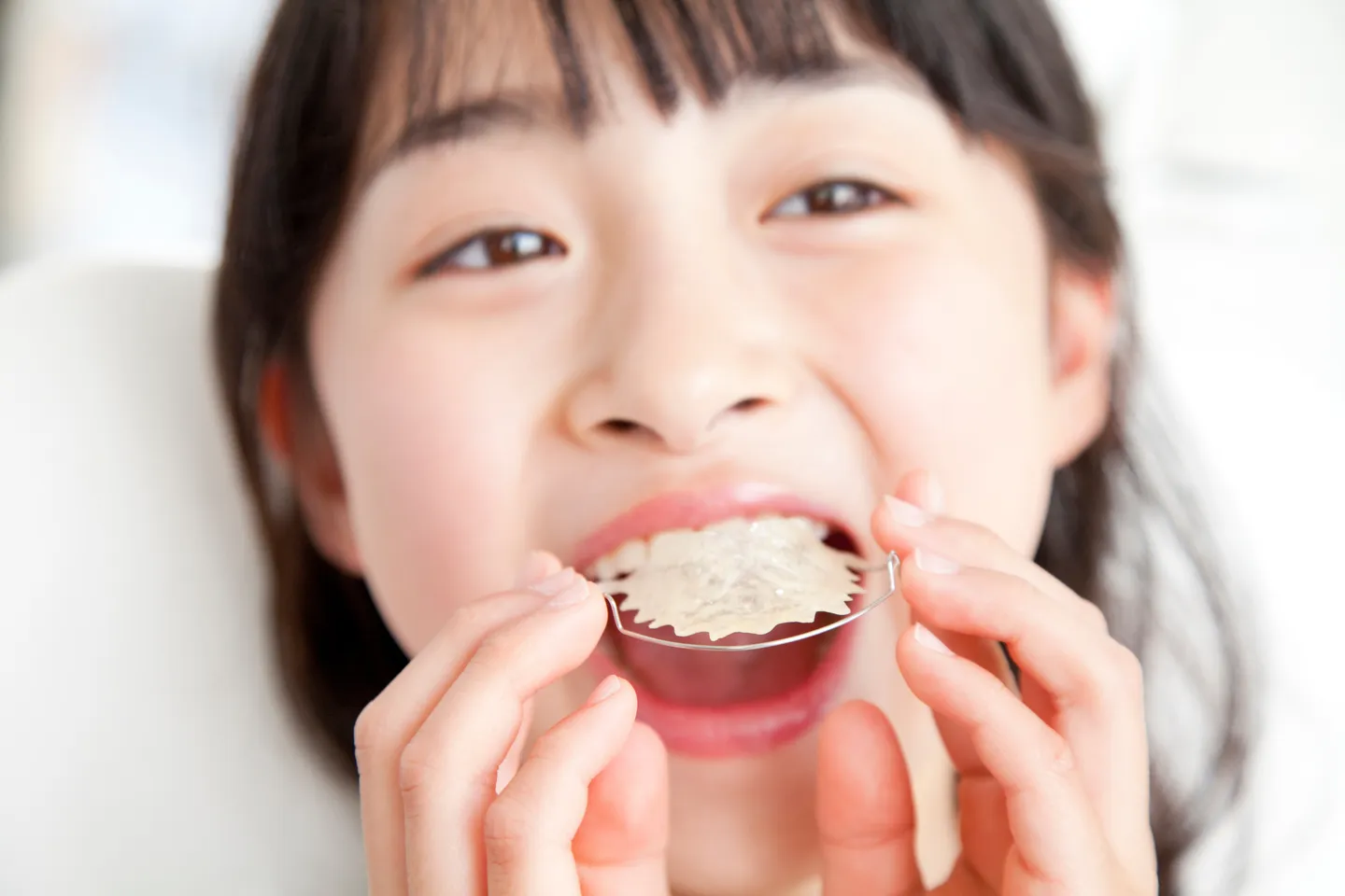 Orthodontic care for kids using impressions for braces and aligners