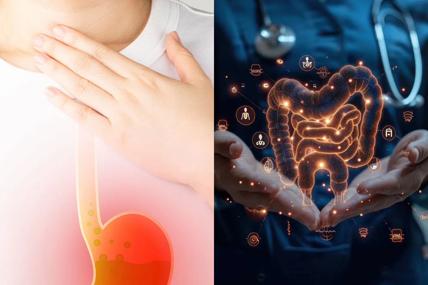 Understanding Kidney Stones