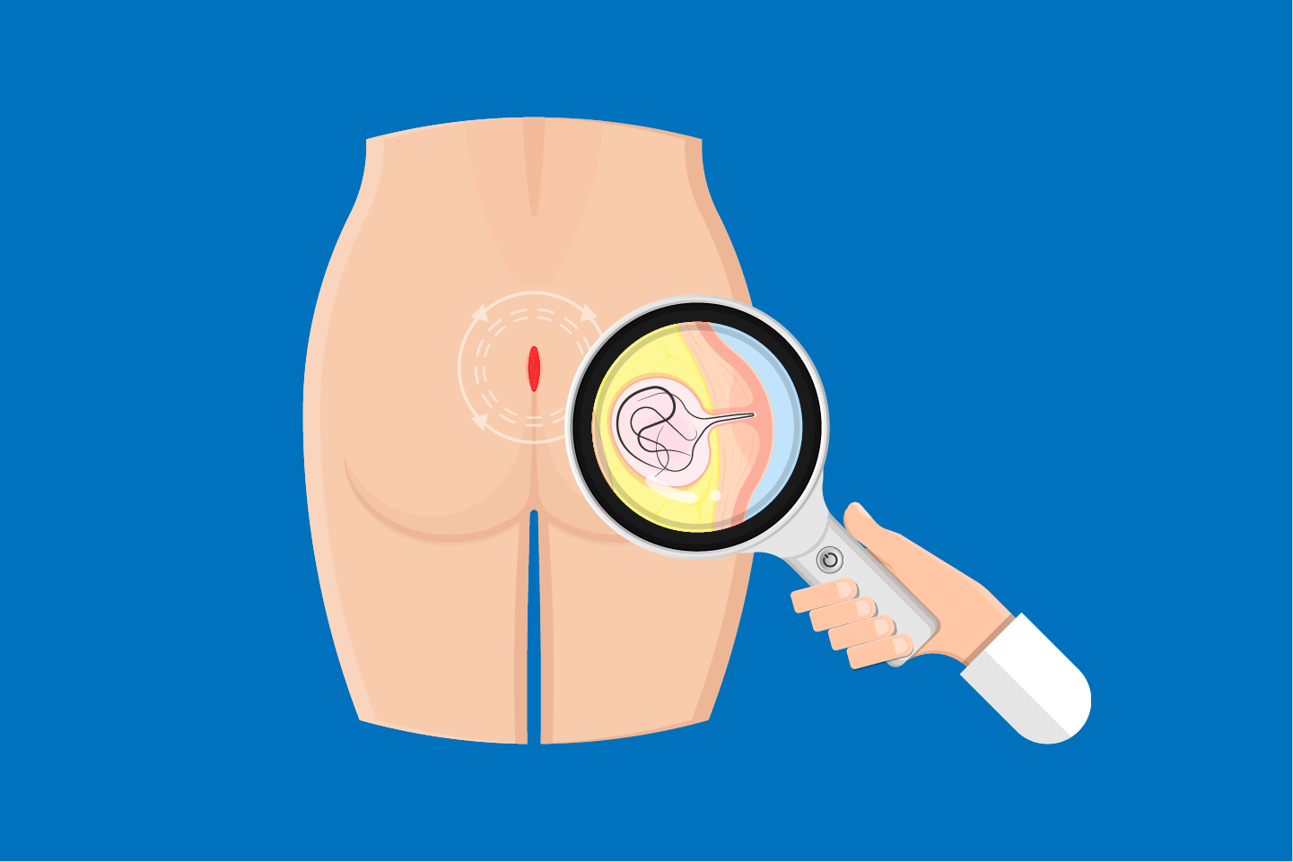 Expert in Anorectal Abscess in Kharghar, Navi Mumbai