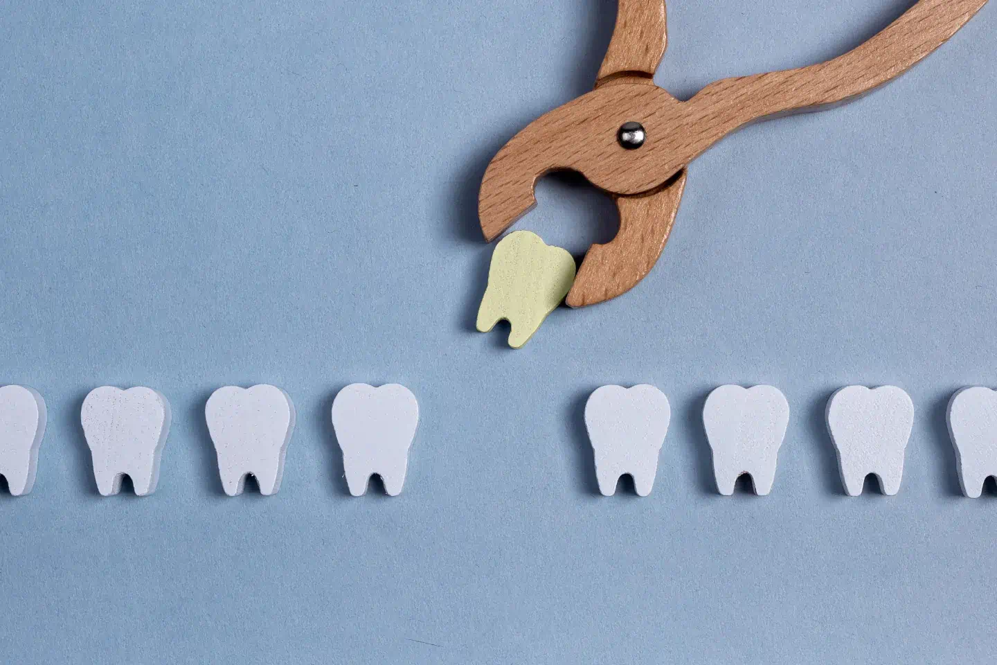 Wisdom Tooth Extraction: What to Expect Before and After Surgery