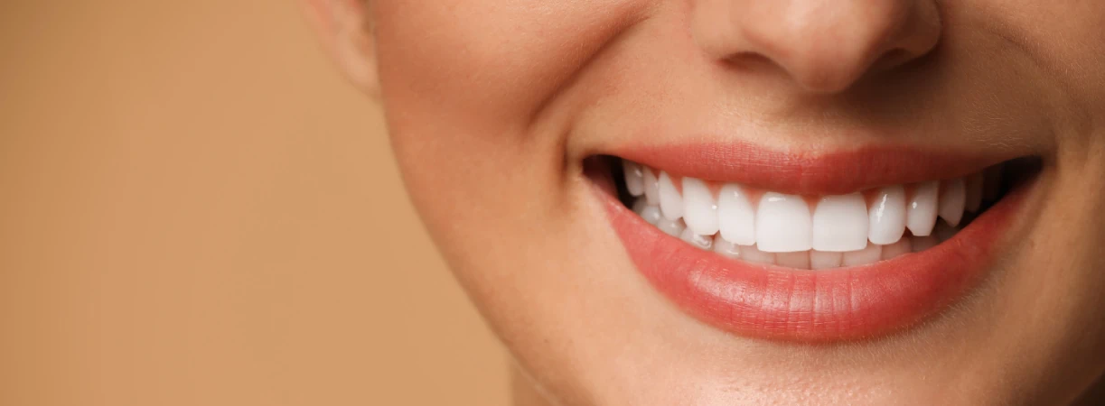 Smile Makeover