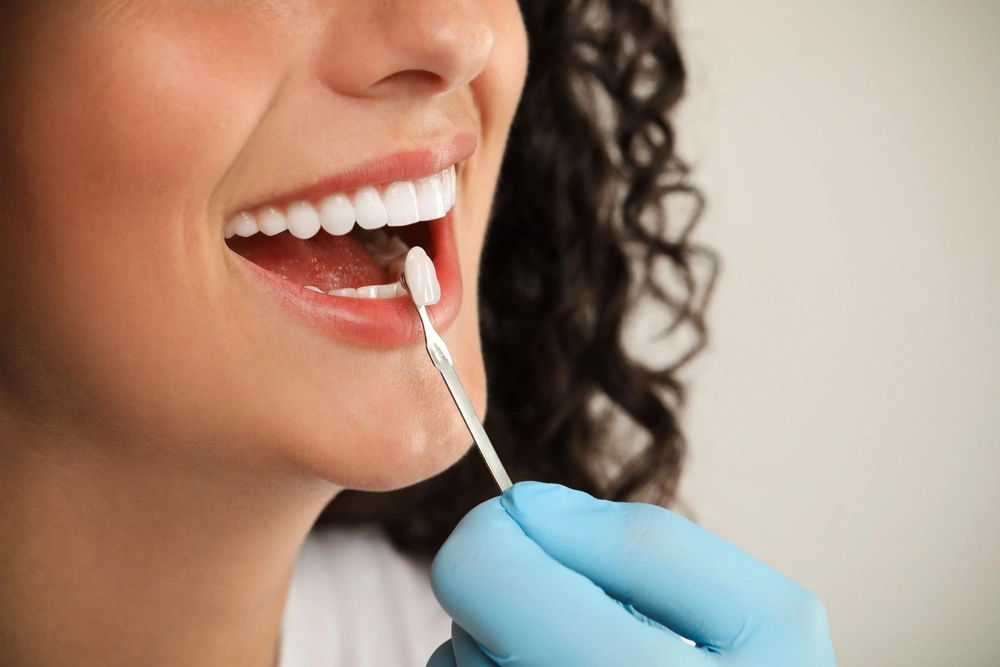 Dental Veneers: Are They the Right Choice for Your Smile?