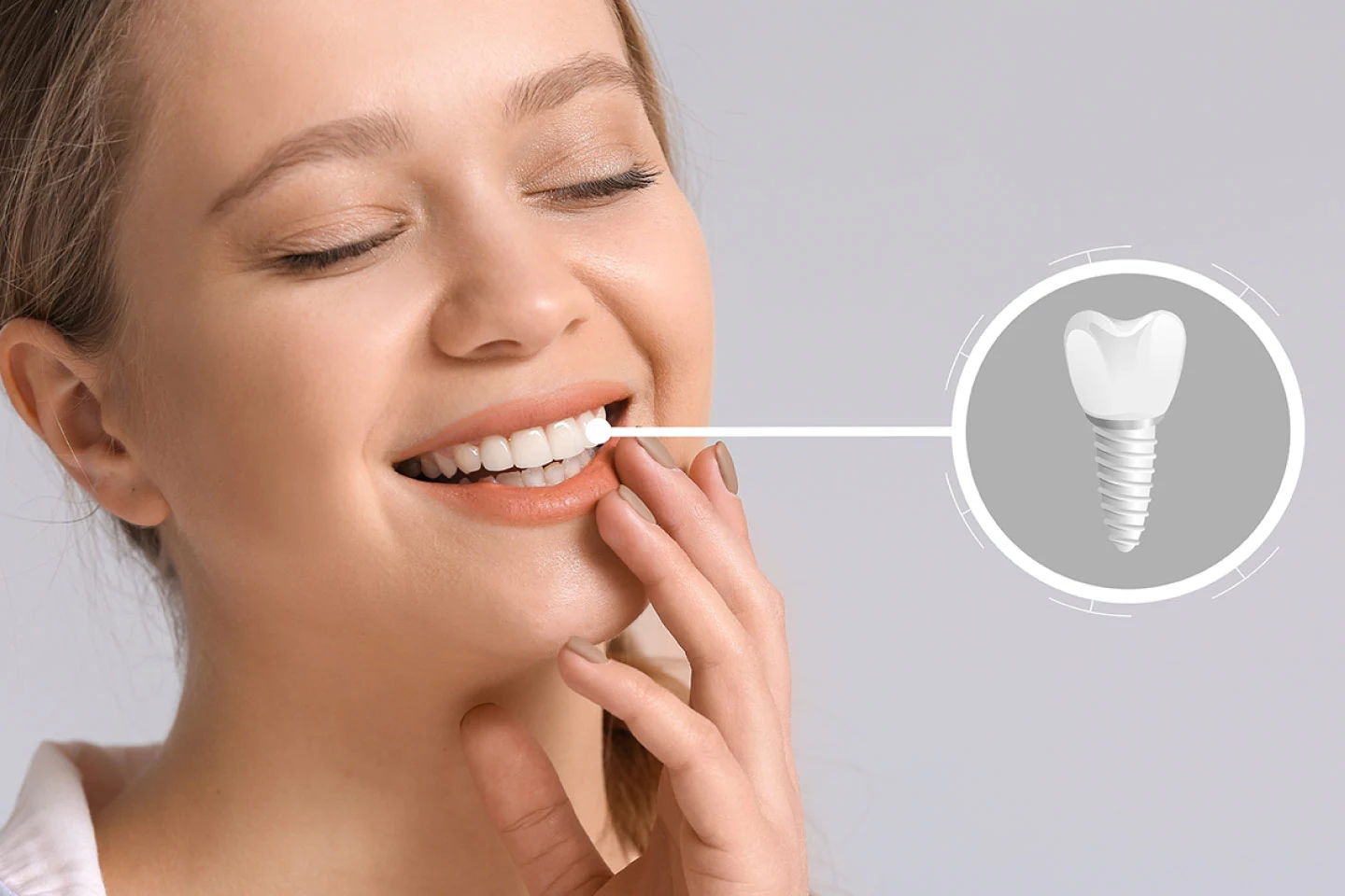 Painless dental implants under the supervision of our expert at Spring Field Dental