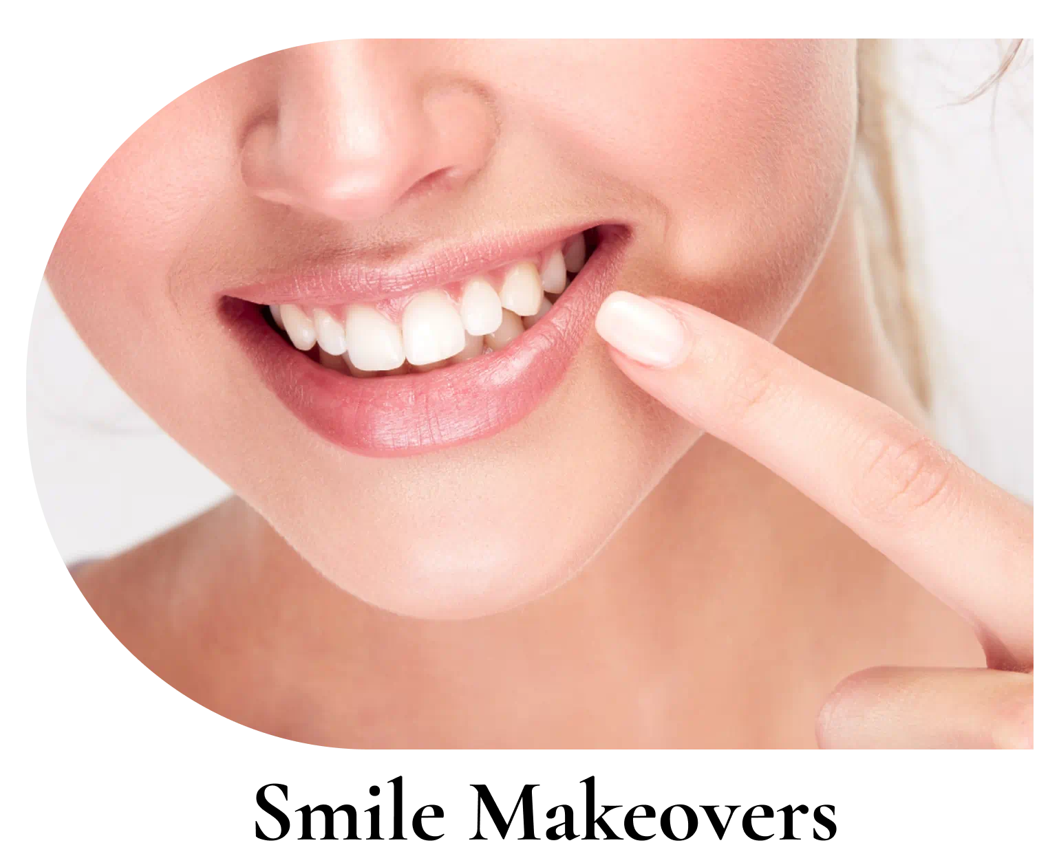 Smile Makeovers