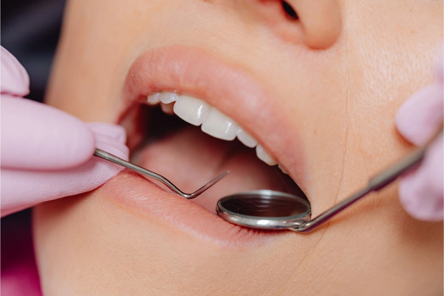 Modern Dental Procedures vs Traditional Dentistry: What’s Changed?