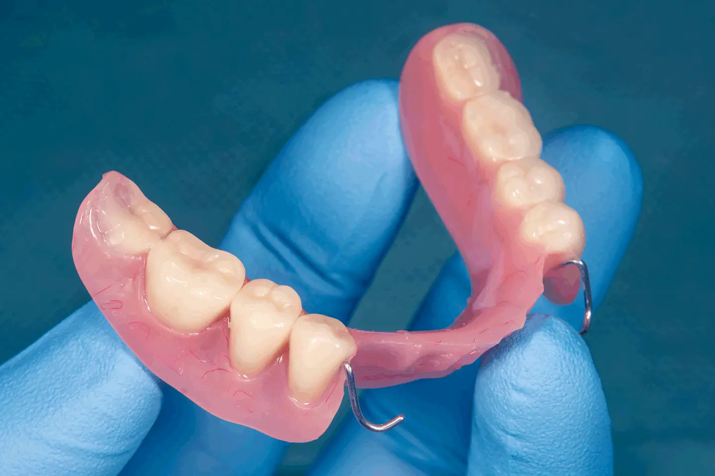 Dental Implants