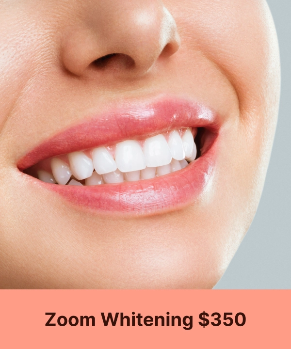 Zoom Whitening Procedures at Sacramento West Dental, CA