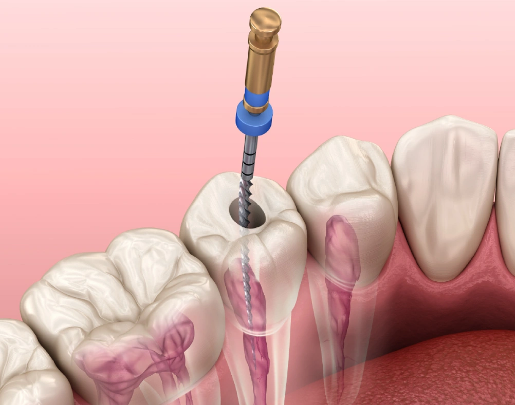 Restorative Dentistry