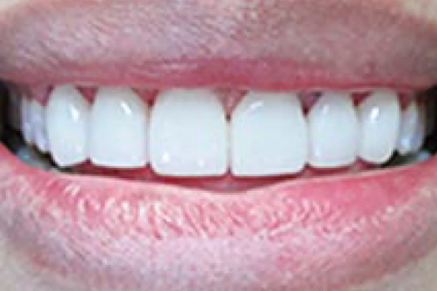 main-image