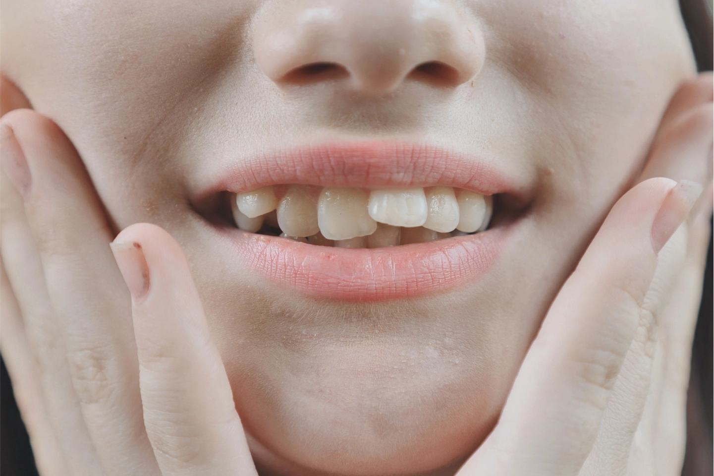 Orthodontic Dental Office: Causes of Crooked Teeth