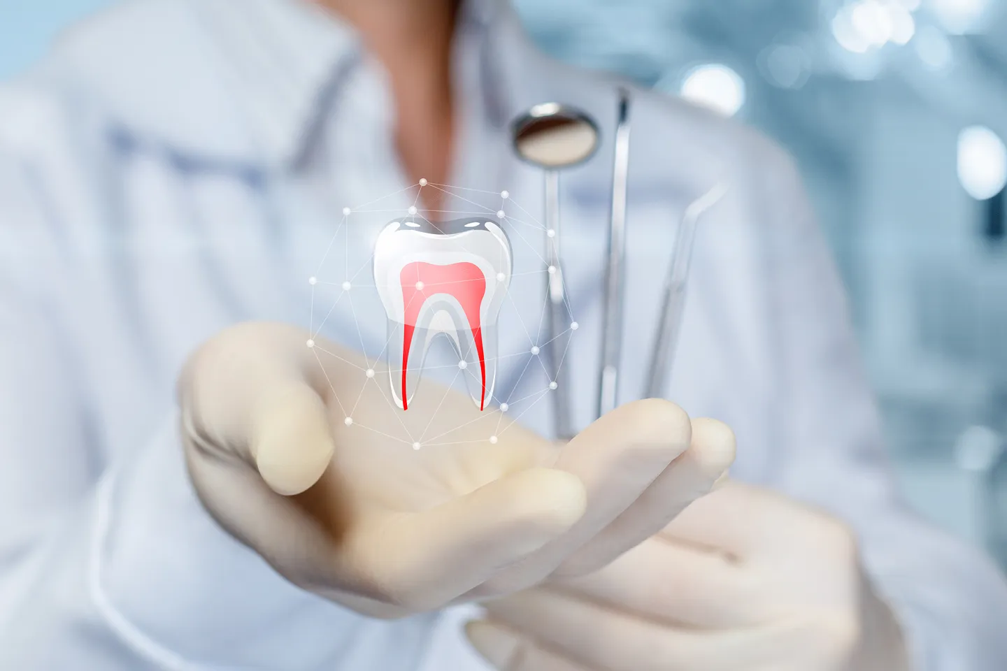 Root Canals