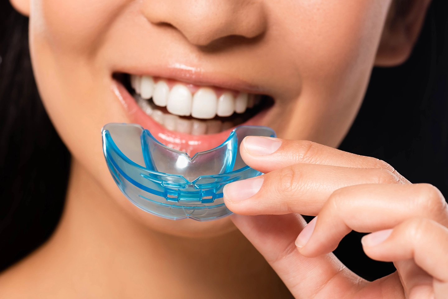 Mouthguards Treatments at Spring Field Dental
