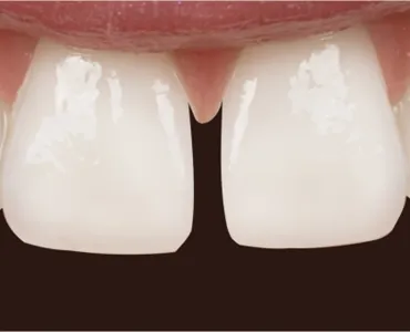 main-image