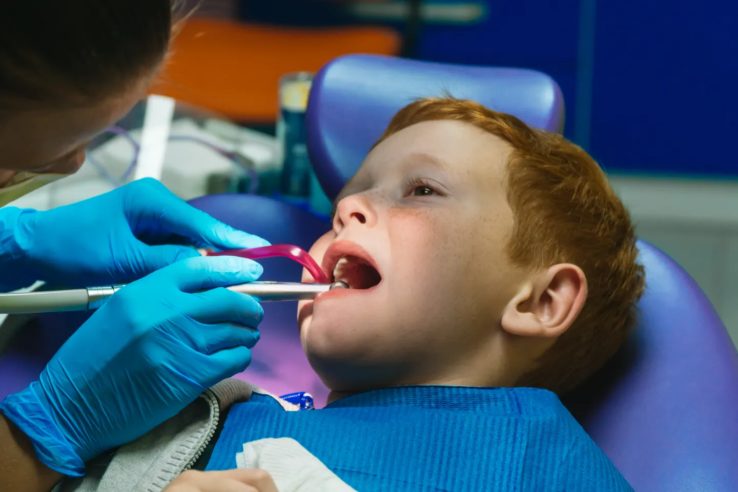 Pediatric Dental Emergencies 
