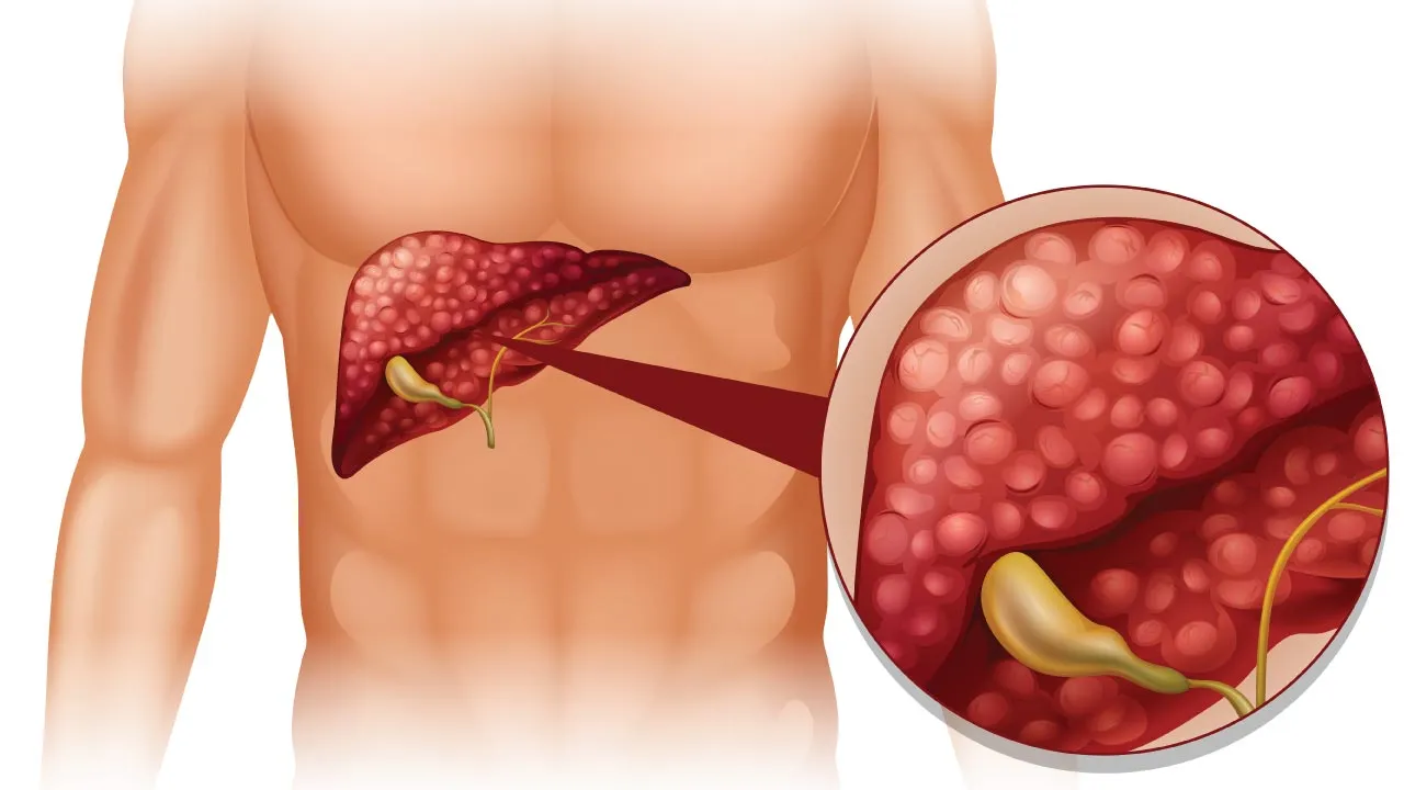 Surgical oncologist explaining gallbladder cancer using a digestive system model during a patient consultation
