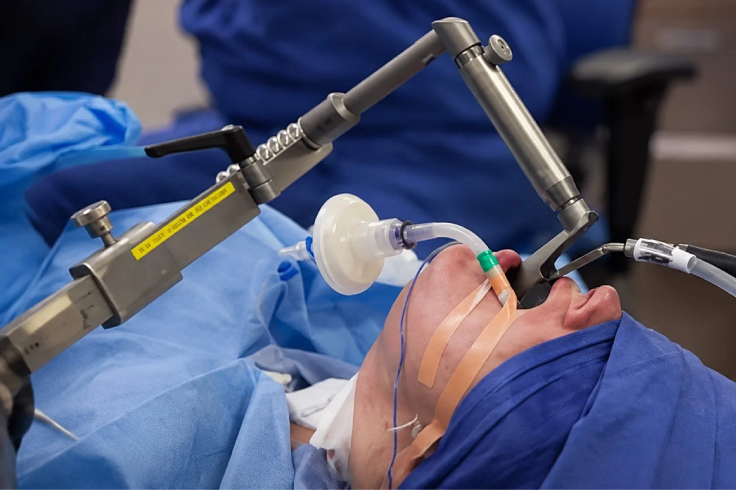 Microlaryngeal Surgery (MLS)