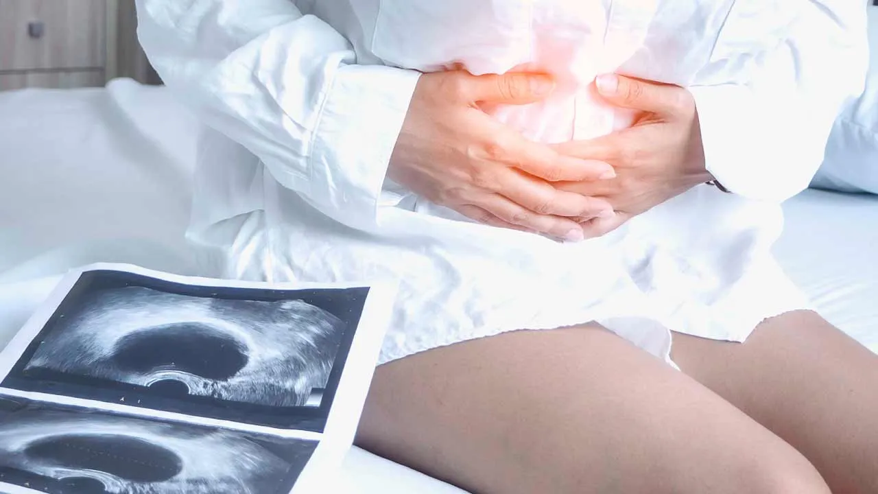 Navigating Ovarian Cysts and the Role of Laparoscopic Surgery in Managing it