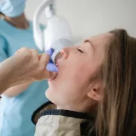 Crowns in One visit – CEREC @ Natural Smiles