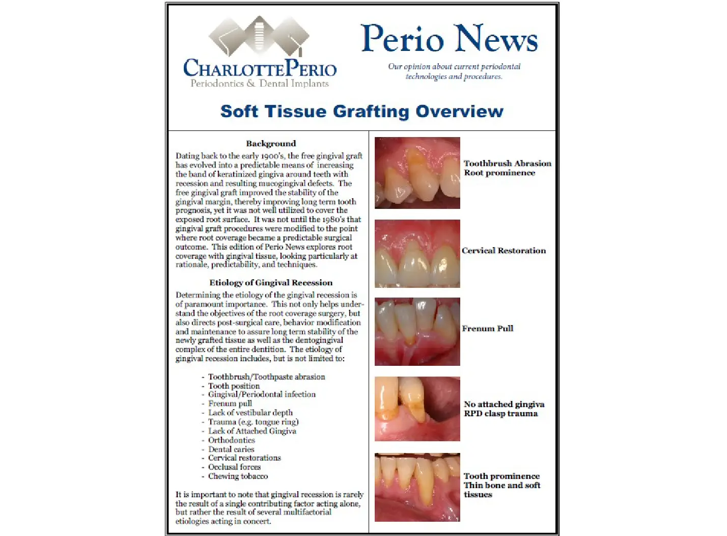 Soft Tissue Grafting Overview