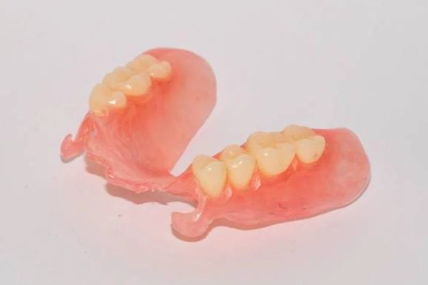 Root Canal Treatment Illustration