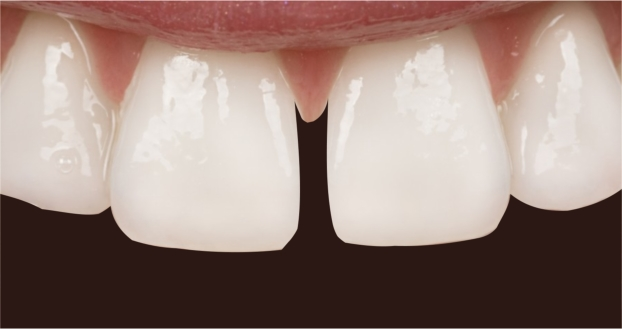 main-image