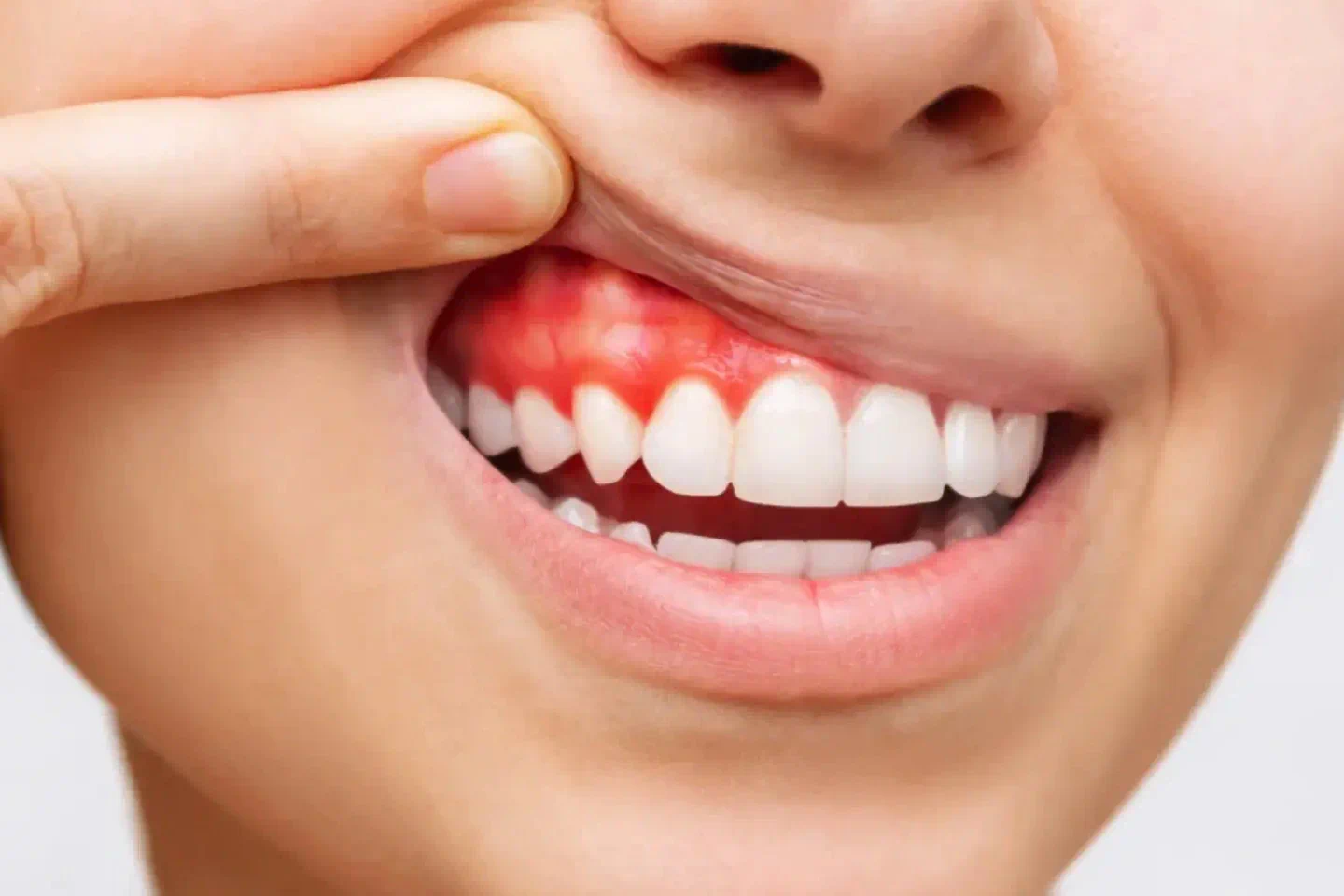 Periodontal Treatment
