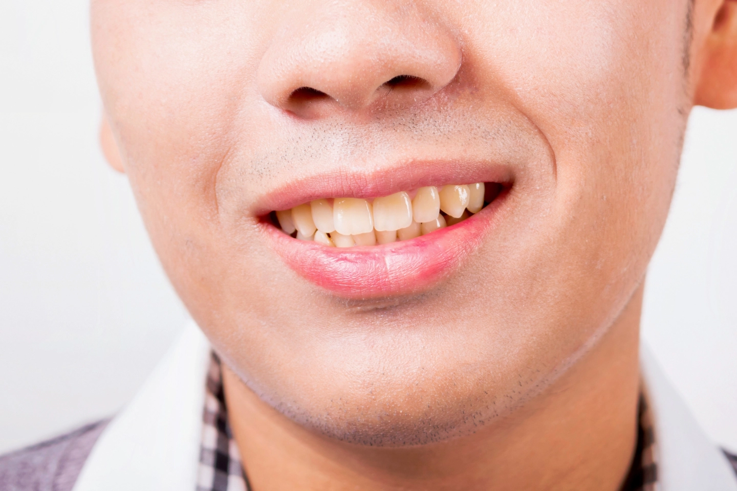 Tips to Avoid Tooth Staining and Discoloration