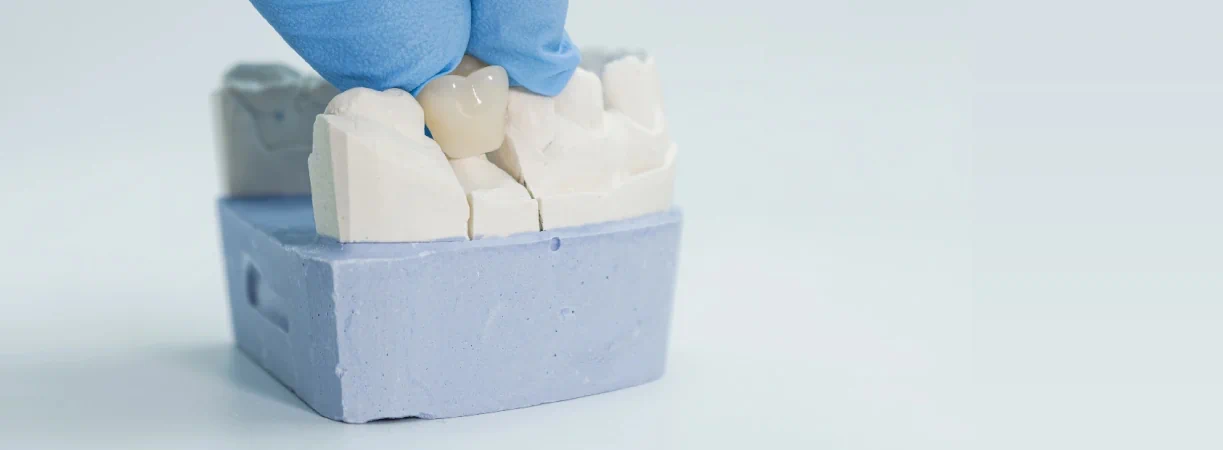 Ceramic Crowns