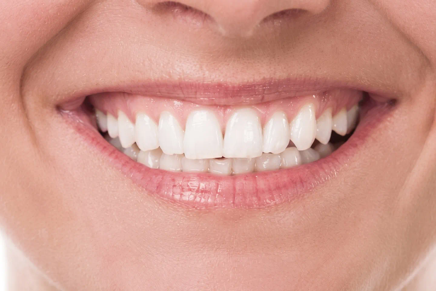 Teeth Whitening
