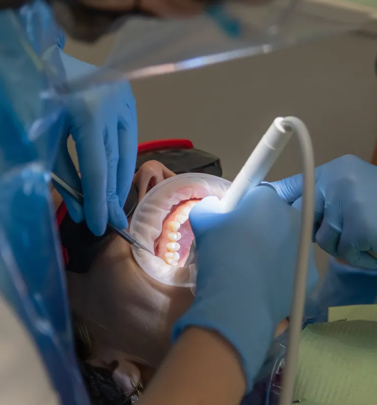 Cavity Detection System