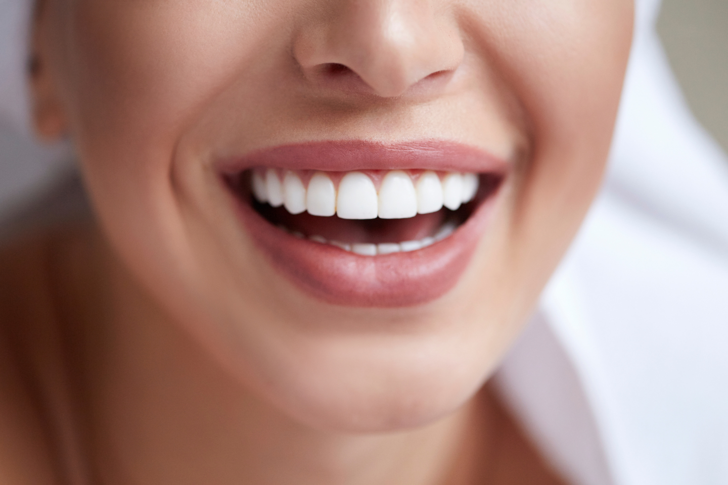 Benefits of Professional Teeth Whitening