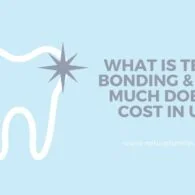 What Is Teeth Bonding & How Much Does It Cost In UK?