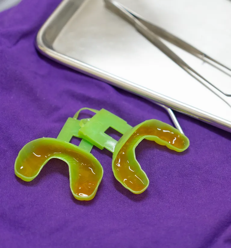 Implant Supported Dentures Model