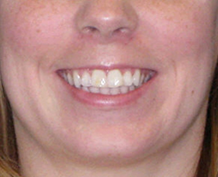 main-image