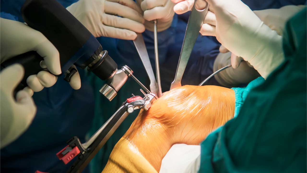 Knee Ligament Injury Illustration